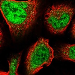 ZNF281 Antibody, Novus Biologicals 25 &mu;L, Unlabeled:Antibodies, Polyclonal